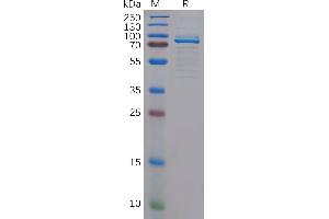 Human c-MPL Protein, hFc Tag on SDS-PAGE under reducing condition. (MPL Protein (AA 26-490) (Fc Tag))