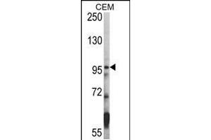 Western blot analysis of hHDAC7-A935 in CEM cell line lysates (35ug/lane) (HDAC7 抗体  (C-Term))