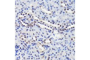 Immunohistochemistry of paraffin-embedded mouse kidney using Phospho-ST-S727 antibody (ABIN6135339, ABIN6136294, ABIN6136295 and ABIN7101885) at dilution of 1:100 (40x lens). (STAT3 抗体  (pSer727))