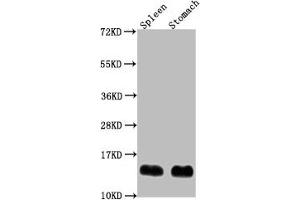 Western Blot Positive WB detected in: Mouse spleen tissue, Mouse stomach tissue All lanes: B2m antibody at 1:2000 Secondary Goat polyclonal to rabbit IgG at 1/50000 dilution Predicted band size: 14 kDa Observed band size: 14 kDa (beta-2 Microglobulin 抗体  (AA 21-119))