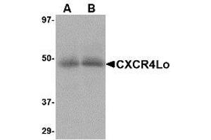 Image no. 1 for anti-Chemokine (C-X-C Motif) Receptor 4 (CXCR4) (N-Term) antibody (ABIN1493919) (CXCR4 抗体  (N-Term))