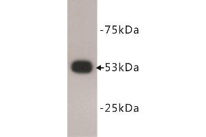 Western Blotting (WB) image for anti-Tumor Protein P53 (TP53) antibody (ABIN1854958) (p53 抗体)