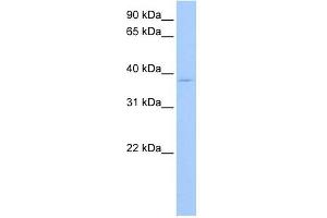 RPL3 antibody used at 1 ug/ml to detect target protein. (RPL3 抗体  (C-Term))
