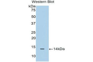 Western Blotting (WB) image for anti-Cyclin-Dependent Kinase 2 (CDK2) (AA 94-198) antibody (ABIN1175171) (CDK2 抗体  (AA 94-198))