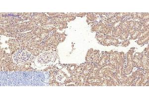 Immunohistochemistry of paraffin-embedded Rat kidney tissue using CD10 Monoclonal Antibody at dilution of 1:200. (MME 抗体)