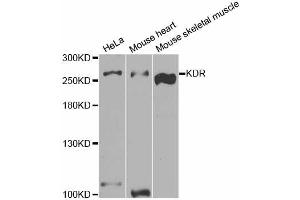Western blot analysis of extracts of various cell lines, using KDR antibody (ABIN5973267) at 1/1000 dilution. (VEGFR2/CD309 抗体)