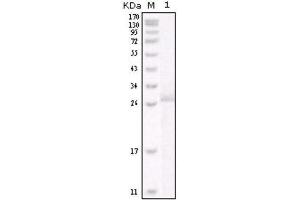 Western Blotting (WB) image for anti-Receptor tyrosine-protein kinase erbB-2 (ErbB2/Her2) antibody (ABIN2843749) (ErbB2/Her2 抗体)