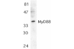 Image no. 1 for anti-Myeloid Differentiation Primary Response Gene (88) (MYD88) (AA 279-296), (C-Term) antibody (ABIN205874) (MYD88 抗体  (C-Term))