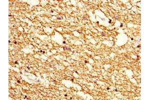 Immunohistochemistry of paraffin-embedded human brain tissue using ABIN7142178 at dilution of 1:100 (Cnpase 抗体  (AA 226-415))