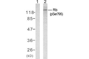 Western blot analysis of extracts from K562 cells untreated or treated with 10% serum after 48 hours of starvation, using Rb (phospho-Ser795) antibody (E011130). (Retinoblastoma 1 抗体  (pSer795))
