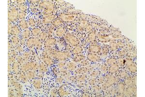ABIN6267452 at 1/100 staining rat kidney tissue sections by IHC-P. (PIK3R1 抗体  (pTyr607))