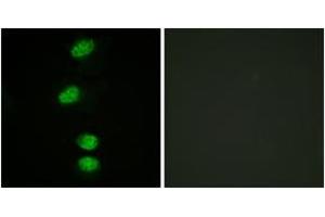 Immunofluorescence analysis of HeLa cells, using Androgen Receptor (Phospho-Ser94) Antibody. (Androgen Receptor 抗体  (pSer94))