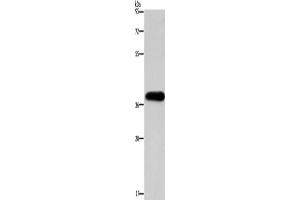 Western Blotting (WB) image for anti-Paired-Like Homeodomain 2 (PITX2) antibody (ABIN2422772) (PITX2 抗体)
