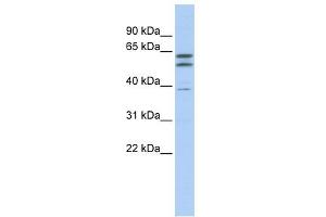 Beta Tubulin 2A antibody used at 1 ug/ml to detect target protein. (beta Tubulin 2A (N-Term) 抗体)