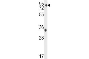 Western Blotting (WB) image for anti-TBK antibody (ABIN3003556) (TBK 抗体)