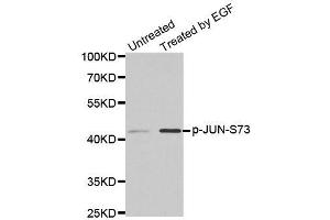 Western blot analysis of extracts from PC14 cells using phospho-JUN-S73 antibody (ABIN2987353). (C-JUN 抗体  (pSer73))