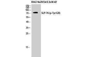 Western Blotting (WB) image for anti-Lymphocyte Cytosolic Protein 2 (SH2 Domain Containing Leukocyte Protein of 76kDa) (LCP2) (pTyr128) antibody (ABIN3179707) (LCP2 抗体  (pTyr128))