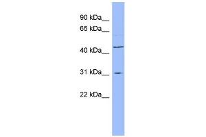 WB Suggested Anti-DHODH Antibody Titration:  0. (DHODH 抗体  (N-Term))