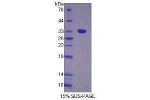 SDS-PAGE analysis of Rat GRB14 Protein. (GRB14 蛋白)