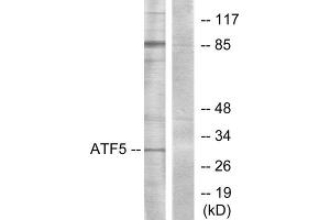 Western blot analysis of extracts from Jurkat cells, using ATF5 antibody. (ATF5 抗体  (C-Term))
