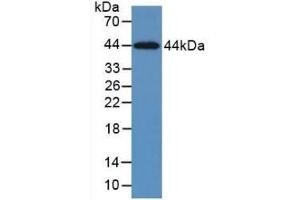 Detection of Recombinant KRT5, Human using Monoclonal Antibody to Cytokeratin 5 (CK5) (Cytokeratin 5 抗体  (AA 168-481))