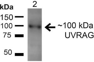 Western blot analysis of Rat Liver showing detection of ~100kDa UVRAG protein using Rabbit Anti-UVRAG Polyclonal Antibody . (UVRAG 抗体  (Biotin))