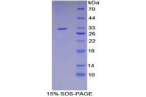 SDS-PAGE analysis of Mouse RYK Protein. (RYK 蛋白)