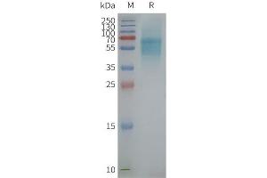 Prokineticin Receptor 1 Protein (PROKR1)