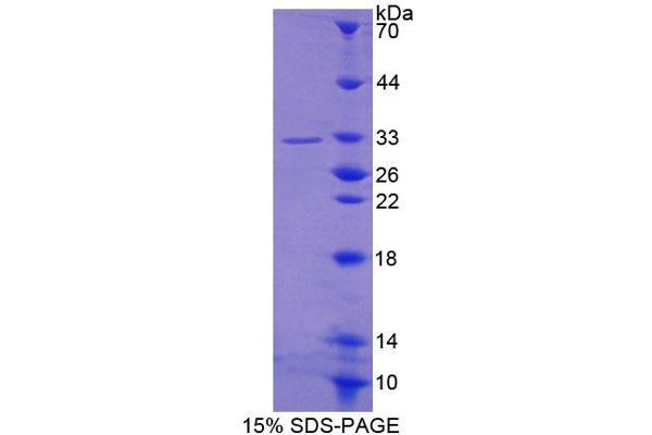 ABCA5 Protein (AA 1401-1642) (T7 tag,His tag)