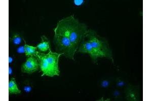 Anti-OSBPL11 mouse monoclonal antibody (ABIN2453406) immunofluorescent staining of COS7 cells transiently transfected by pCMV6-ENTRY OSBPL11 (RC209418). (OSBPL11 抗体)