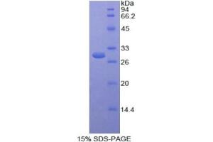 SDS-PAGE analysis of Human SELENBP1 Protein. (SELENBP1 蛋白)