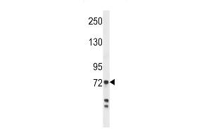 Western blot analysis in MDA-MB231 cell line lysates (35ug/lane). (Myeloperoxidase 抗体  (AA 420-448))