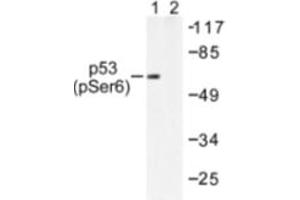 Image no. 2 for anti-Tumor Protein P53 (TP53) (pSer6) antibody (ABIN318095) (p53 抗体  (pSer6))