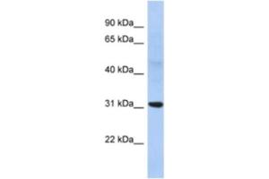 Western Blotting (WB) image for anti-NP antibody (ABIN2463918) (NP 抗体)