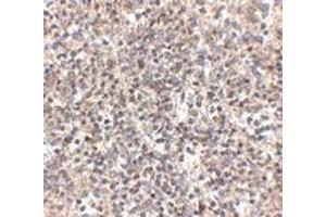 Immunohistochemistry (IHC) image for anti-R-Spondin 1 (RSPO1) (N-Term) antibody (ABIN1031546) (RSPO1 抗体  (N-Term))