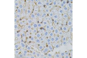Immunohistochemistry of paraffin-embedded mouse liver using MSN antibody. (Moesin 抗体)