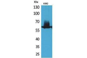 Western Blotting (WB) image for anti-Nuclear Factor-kB p65 (NFkBP65) (Thr743) antibody (ABIN3187851) (NF-kB p65 抗体  (Thr743))