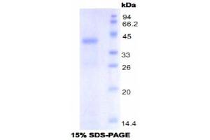 SDS-PAGE analysis of Mouse Toll Like Receptor 4 Protein. (TLR4 蛋白)