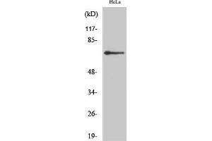 Western Blot analysis of HeLa cells using AR-β2 Polyclonal Antibody diluted at 1:2000. (Androgen Receptor beta 2 抗体  (AA 180-260))