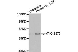 Western Blotting (WB) image for anti-Myc Proto-Oncogene protein (MYC) (pSer373) antibody (ABIN1870452) (c-MYC 抗体  (pSer373))