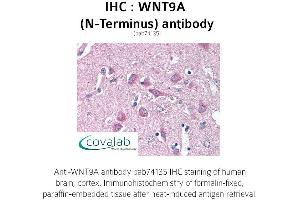 Image no. 1 for anti-Wingless-Type MMTV Integration Site Family, Member 9A (WNT9A) (N-Term) antibody (ABIN1740844) (WNT9A 抗体  (N-Term))