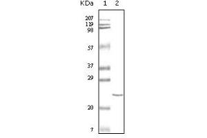 Western blot analysis using cTnI mouse mAb against truncated cTnI recombinant protein. (TNNI3 抗体)