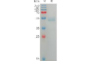 Human ANG Protein, His Tag on SDS-PAGE under reducing condition. (ANGPTL7 Protein (AA 27-346) (His tag))