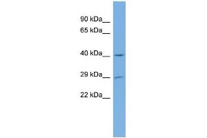 WB Suggested Anti-NAT15 Antibody Titration:  0. (NAT15 抗体  (Middle Region))