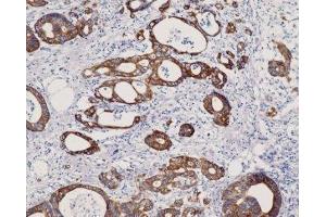 Immunohistochemistry (IHC) image for anti-Keratin 8 (KRT8) (C-Term) antibody (ABIN870549) (KRT8 抗体  (C-Term))