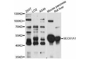 Western blot analysis of extracts of various cell lines, using SEC61A1 antibody (ABIN5998770) at 1:3000 dilution. (SEC61A1 抗体)