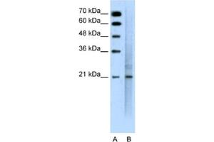 Western Blotting (WB) image for anti-Mucin 1 (MUC1) antibody (ABIN2462410) (MUC1 抗体)