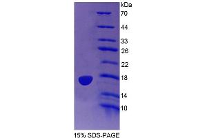 SDS-PAGE analysis of Human PTPMT1 Protein. (PTPMT1 蛋白)