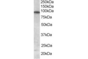 Western Blotting (WB) image for anti-Forkhead Box O3 (FOXO3) (C-Term) antibody (ABIN2465213) (FOXO3 抗体  (C-Term))