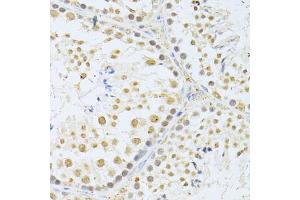 Immunohistochemistry of paraffin-embedded mouse testis using AKT1 antibody (ABIN5997218) at dilution of 1/100 (40x lens). (AKT1 抗体)